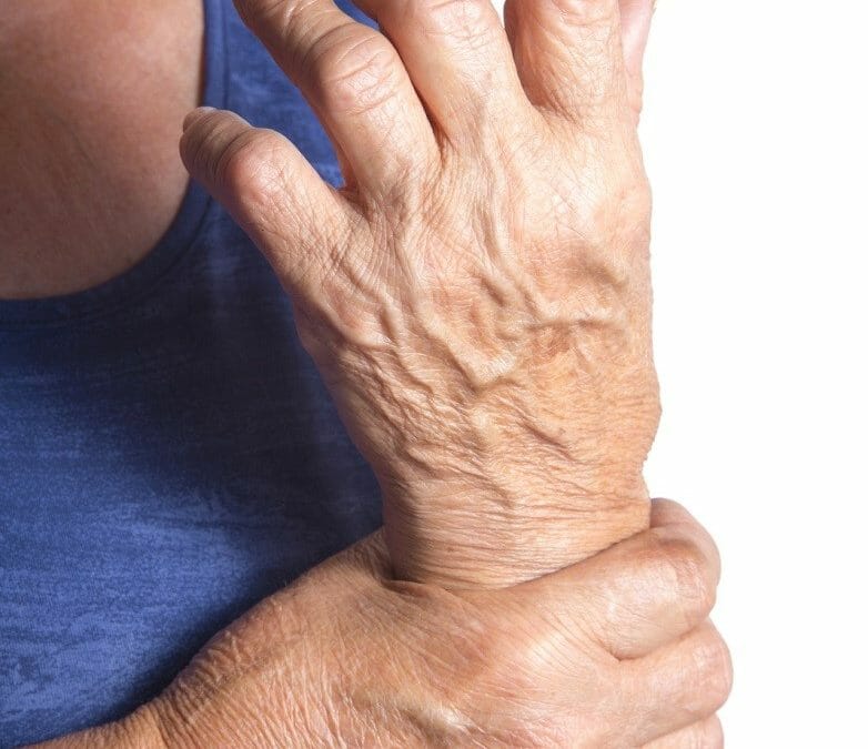 relief of rheumatoid arthritis
