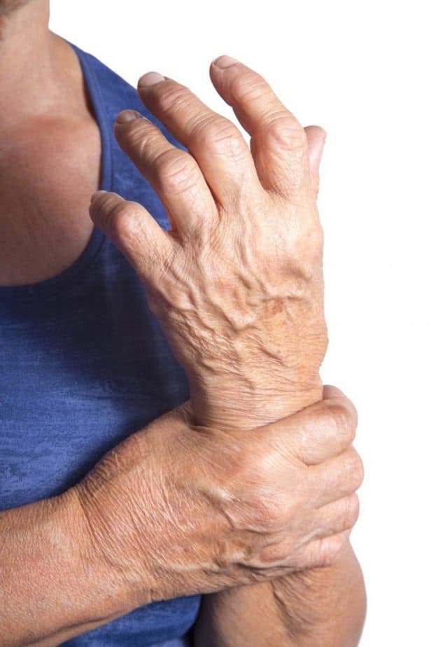 relief of rheumatoid arthritis
